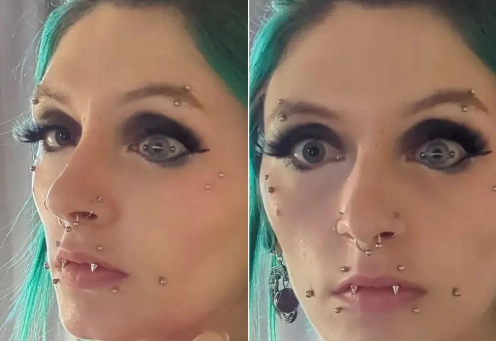 Em  um vídeo, Bree exibe uma pequena barra de metal que aparenta atravessar a lateral da pupila