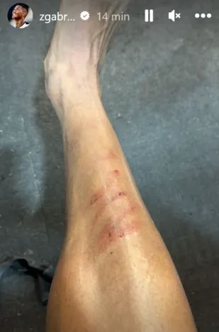 Volante Zé Gabriel postou em suas redes sociais a canela machucada. Jogador do Bangu recebeu apenas amarelo