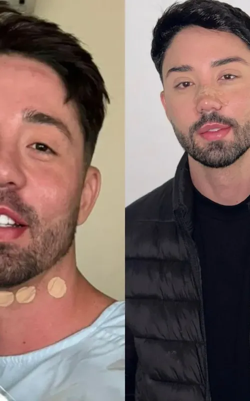 Ele mostrou uma comparação de fotos em seu post