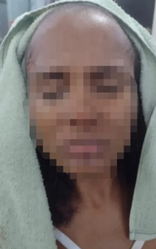 O agressor alegou que a vítima começou a raspar a cabeça "do nada" e o atacou com vários socos
