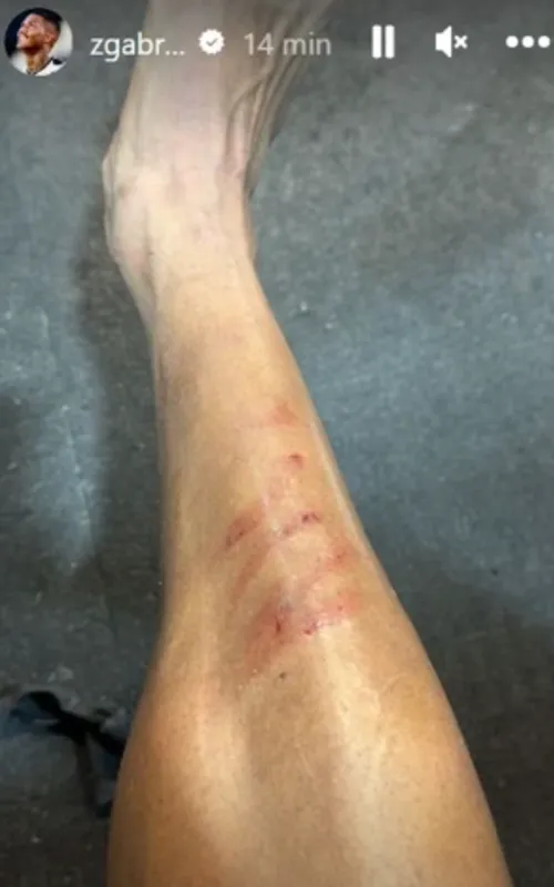 Volante Zé Gabriel postou em suas redes sociais a canela machucada. Jogador do Bangu recebeu apenas amarelo