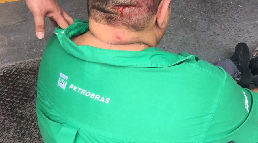 Marcius de Lima sofreu ferimentos na região da cabeça
