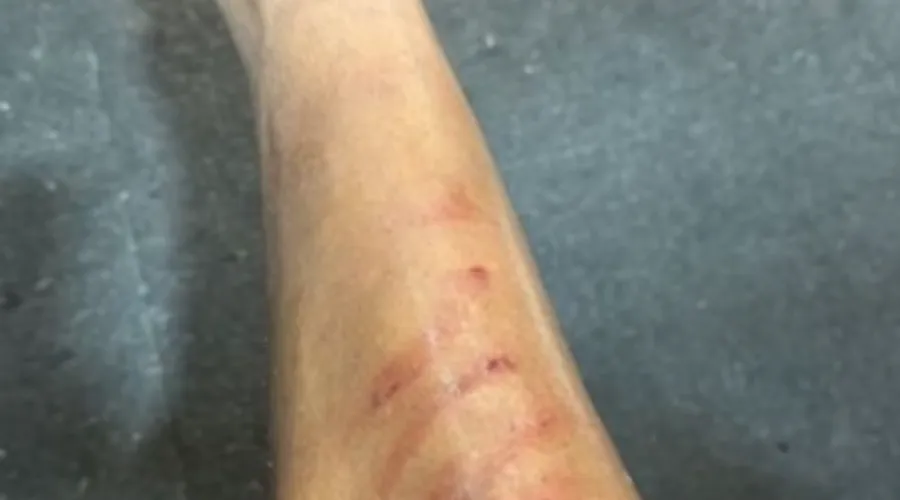 Volante Zé Gabriel postou em suas redes sociais a canela machucada. Jogador do Bangu recebeu apenas amarelo