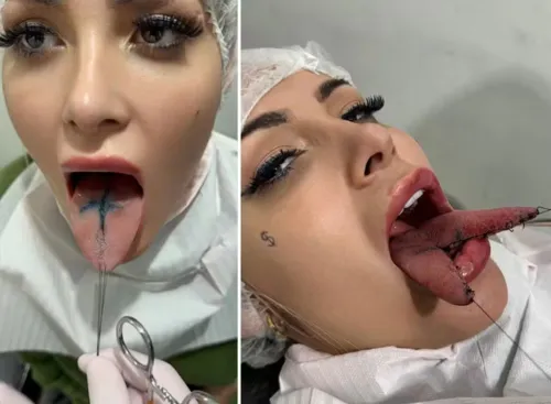 Andressa Urach faz procedimento de língua de cobra em busca de maior prazer