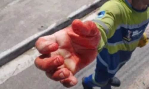 Imagem de funcionário da limpeza ferido em São Gonçalo circulou nas redes sociais; não foi informada a data do acidente