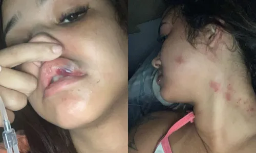 Imagem ilustrativa da imagem Influenciadora de Niterói denuncia pagodeiro por agressão