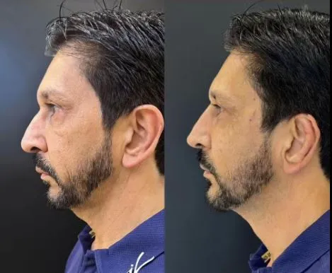 Segundo a clínica, foi realizado um "tratamento facial"