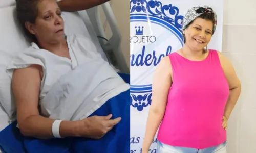 Antes e depois da professora Carini Pereira, de 47 anos