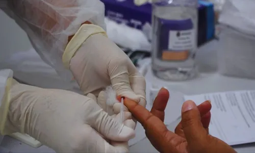 Ação marca o Dia Nacional de Combate à Sífilis e oferecerá testes rápidos em 62 unidades de saúde