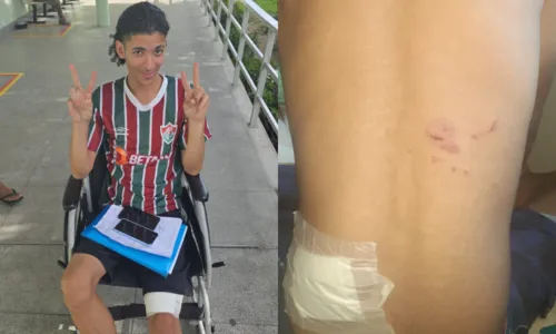 Welber Pinheiro foi atingido na perna esquerda e nas costas