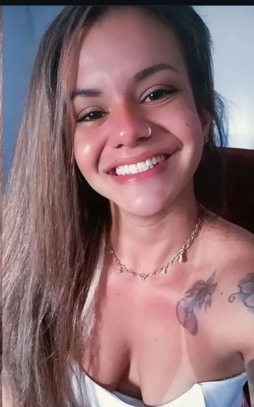 Juliane teve múltiplas fraturas no rosto e ainda passará por cirurgia reconstrutiva