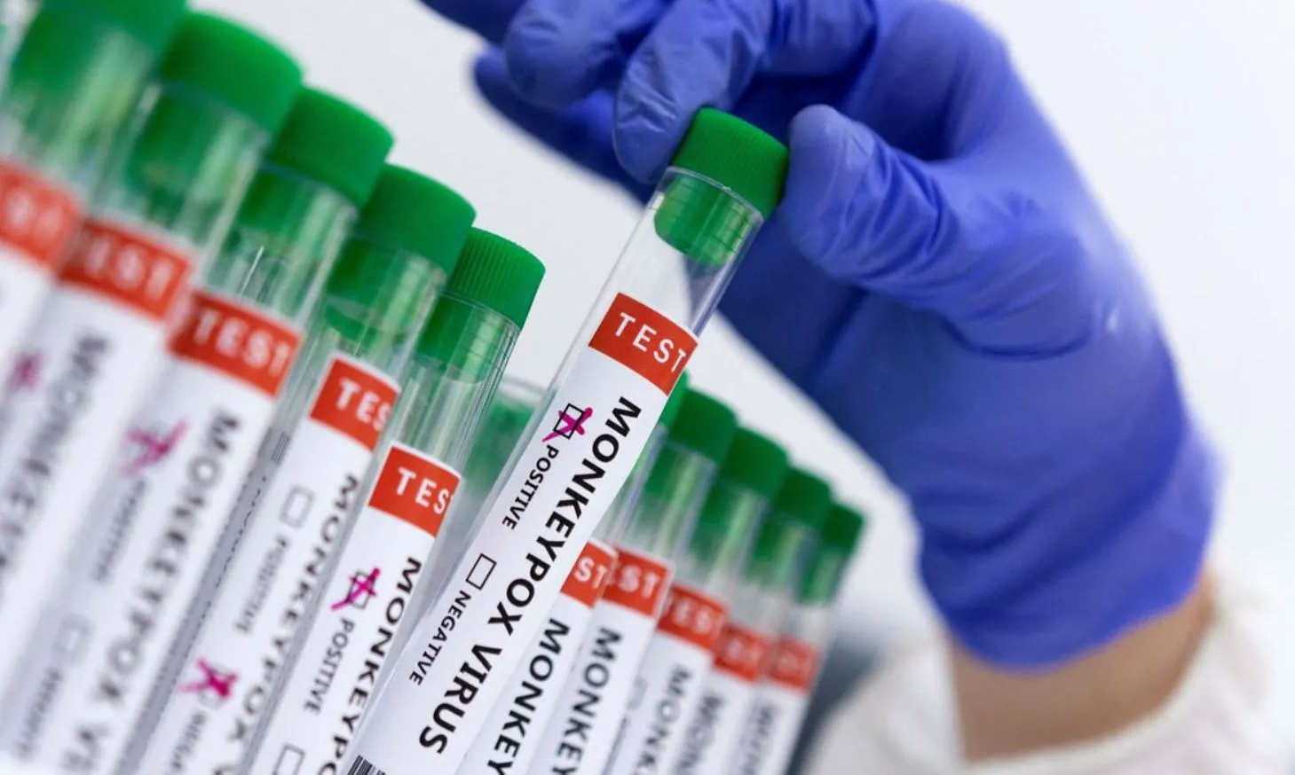 Sete pessoas já testaram positivo para a Varíola dos Macacos em solo brasileiro