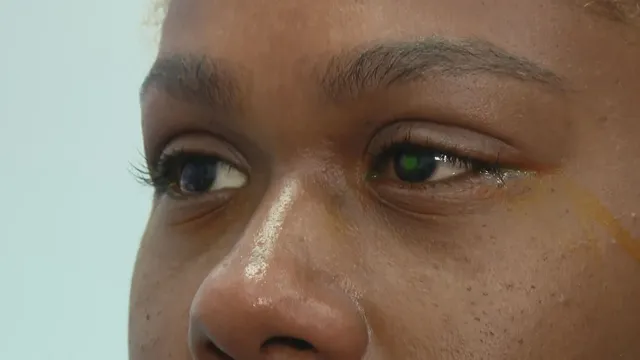 Centenas de pessoas relataram ter sofrido lesões nos olhos após contato
