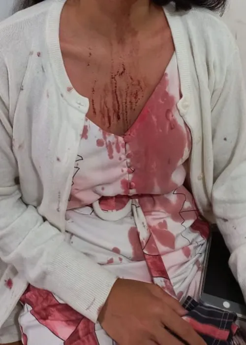 A estudante ficou com a roupa manchadas de sangue