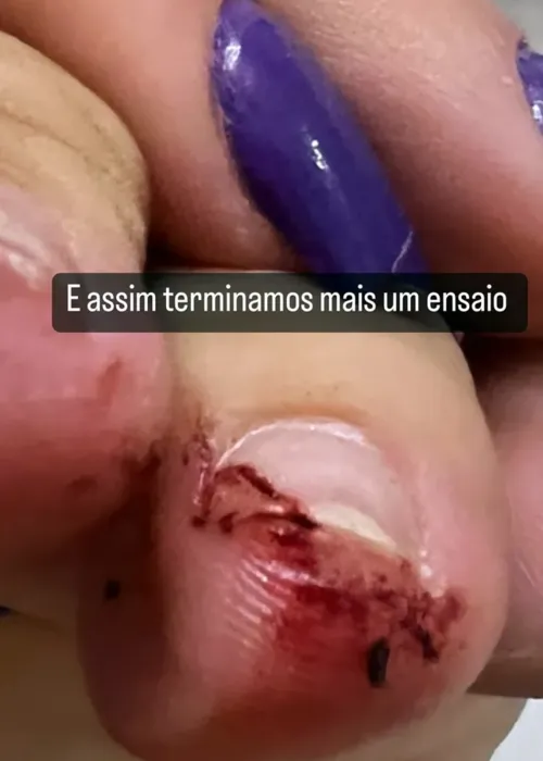 Cantora mostra o pé ferido e com sangue