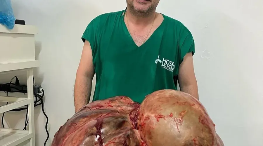 Cirurgia foi realizada pelo médico Gláucio Boechat