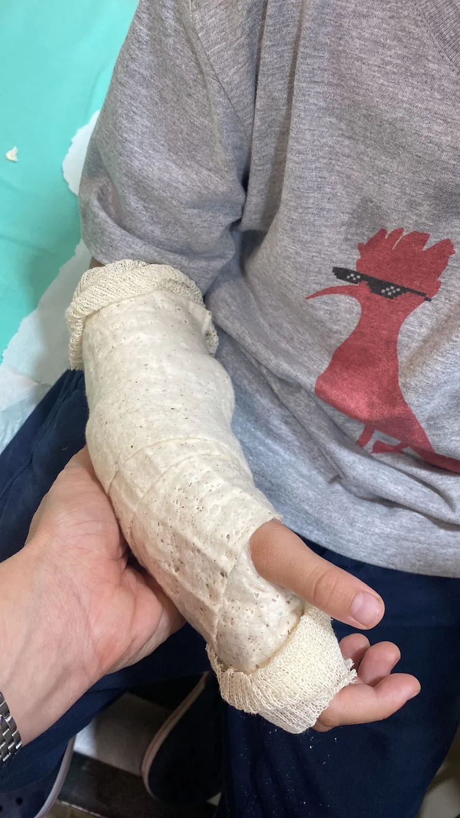 Criança de 7 anos teve um dos braços quebrados no acidente