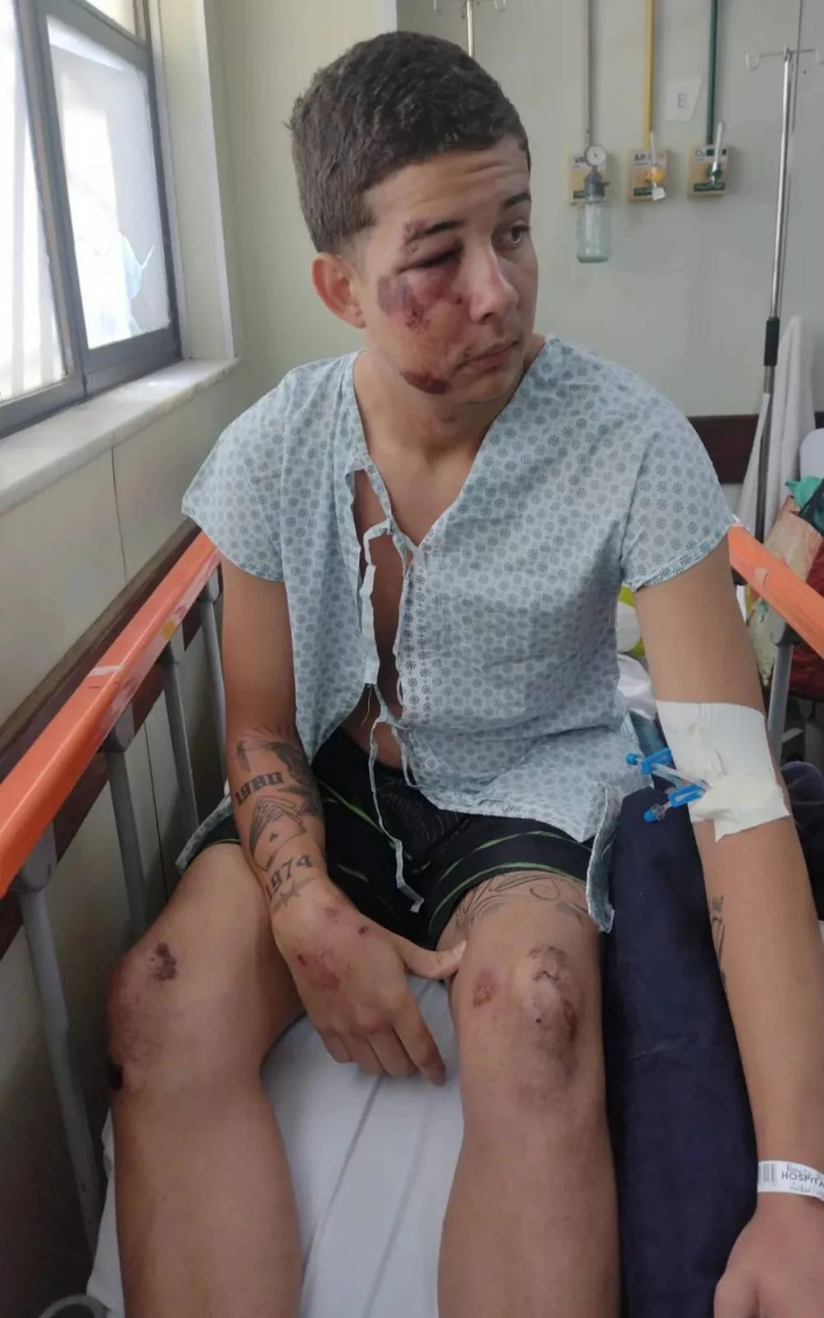 Renato de Araújo Sardinha Filho, de 18 anos, foi agredido durante o Carnaval