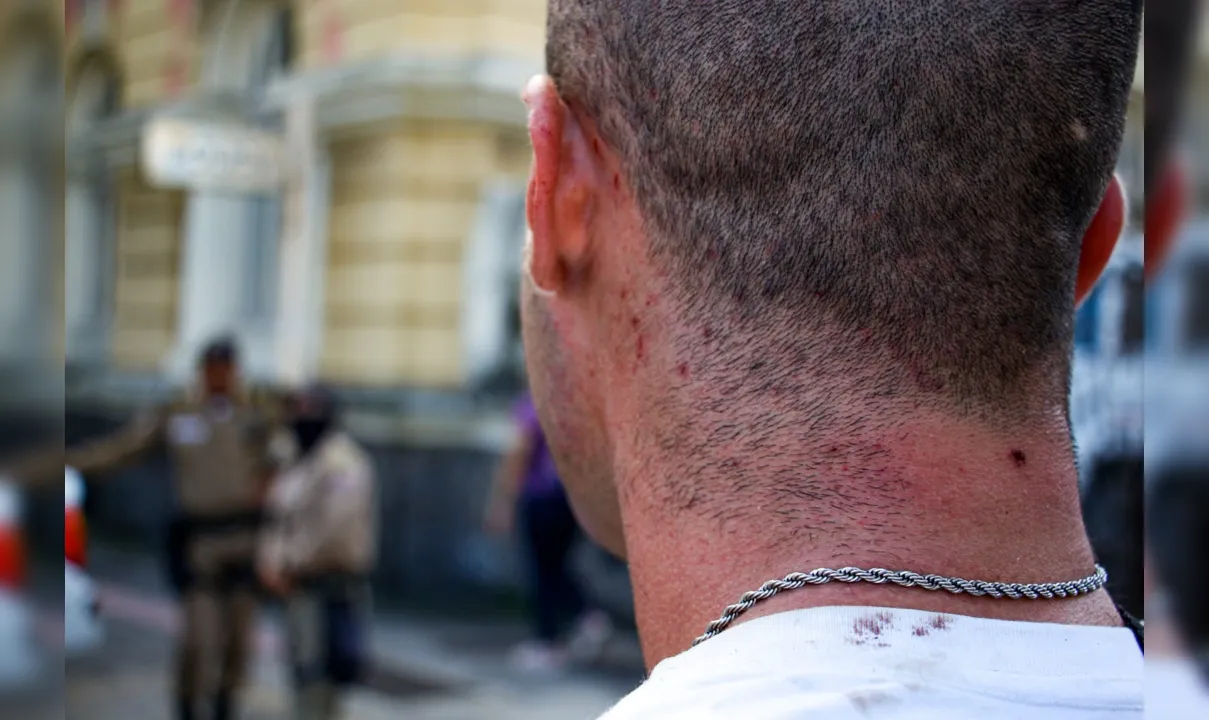 Sangue escorreu ainda na cabeça