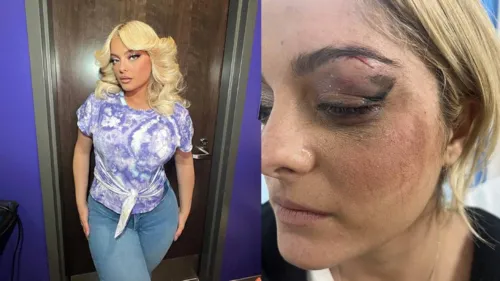 Bebe Rexha chegou a compartilhar imagens de como ficou seu rosto