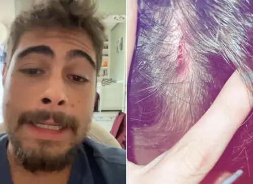 Na imagem é possível ver um corte ainda com rastros de sangue