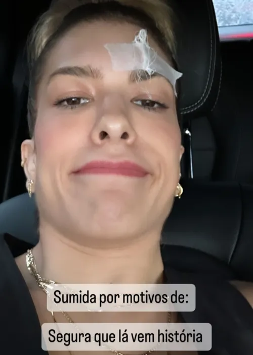 Dançarina mostrou o ferimento nas redes