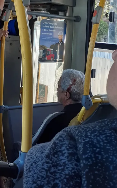A vítima teve ferimentos na cabeça, sobrancelha, na boca e na mão