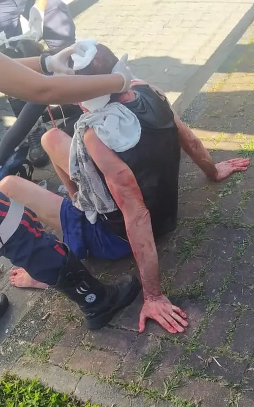 Policiais encontraram o homem ensanguentado e sentado na calçada em frente ao prédio
