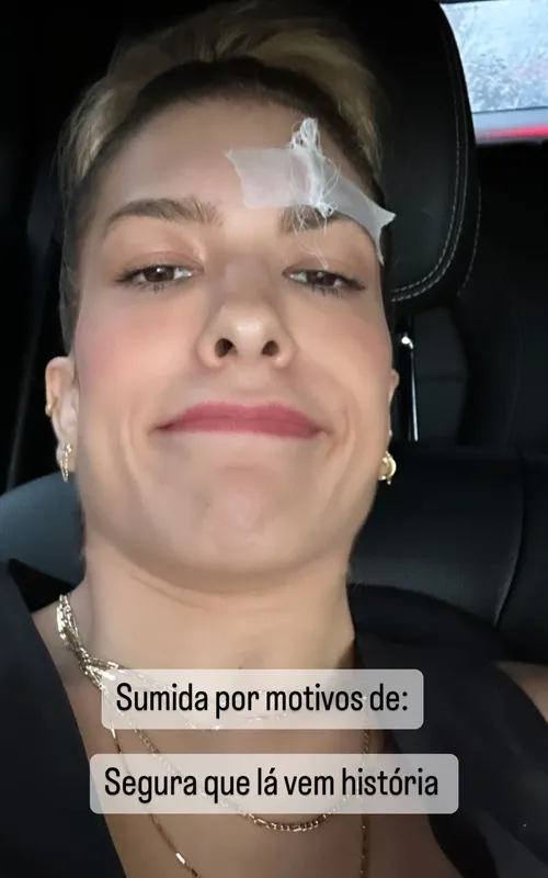Dançarina mostrou o ferimento nas redes
