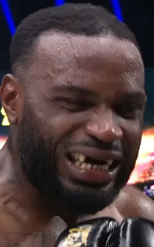 Lutador perdeu os dentes frontais durante combate
