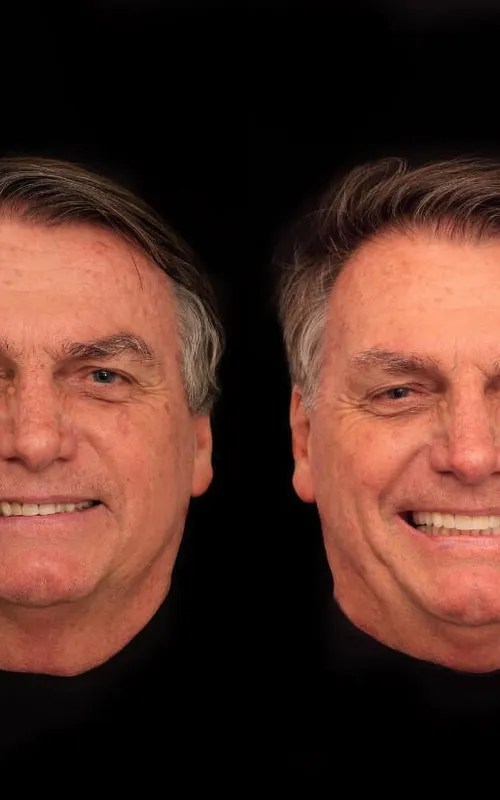 O procedimento foi realizado em Goiânia (GO), pelo dentista Rildo Lasmar