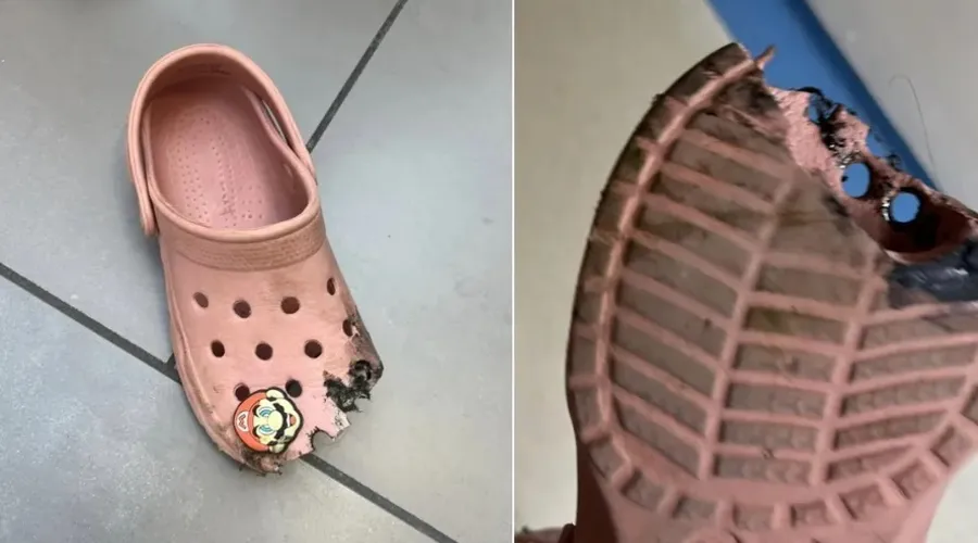 O calçado da criança ficou parcialmente destruído