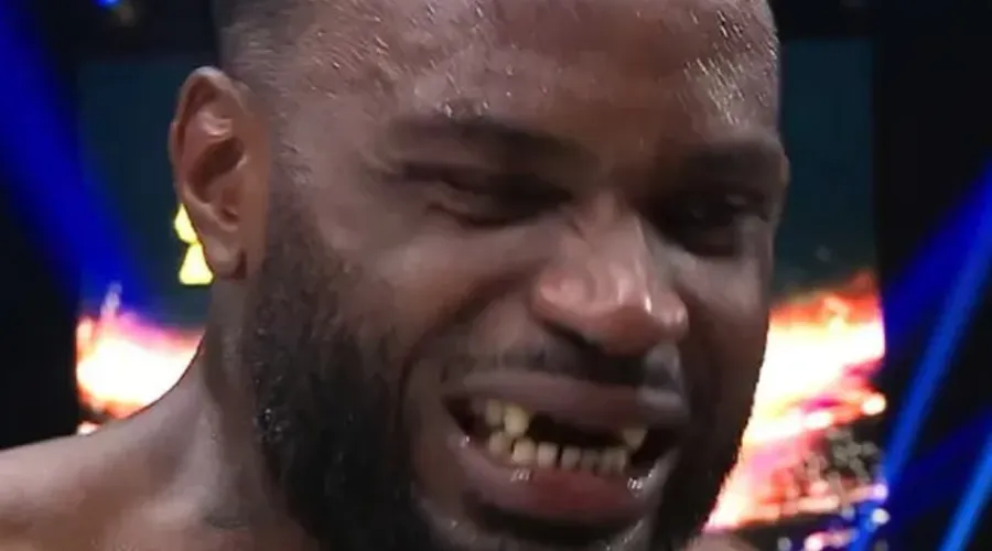 Lutador perdeu os dentes frontais durante combate