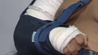 Imagem ilustrativa da imagem Aluno autista tem braço quebrado em escola; família acusa professor