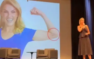 Imagem ilustrativa da imagem Ana Hickmann mostra hematomas de agressão e chora