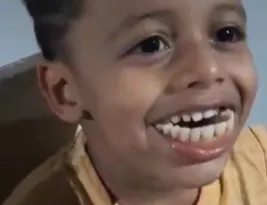 Imagem ilustrativa da imagem Doce ou travessura? Criança confunde dentadura do tio com bala