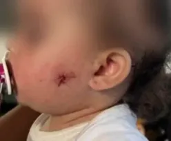 Imagem ilustrativa da imagem PM atira em rosto de criança com arma de airsoft em SP; vídeo