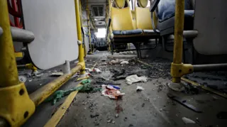 Imagem ilustrativa da imagem Passageiro atingido por bomba em ônibus precisa de doação de sangue