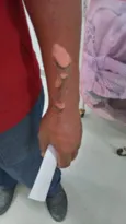Imagem ilustrativa da imagem Explosão deixa servidor ferido no Hospital Antônio Pedro, em Niterói