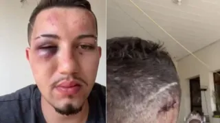 Imagem ilustrativa da imagem Casal é agredido por policiais em Minas Gerais; veja vídeo