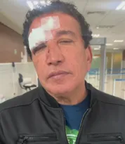 Imagem ilustrativa da imagem Senador Magno Malta sofre acidente em viagem com Bolsonaro