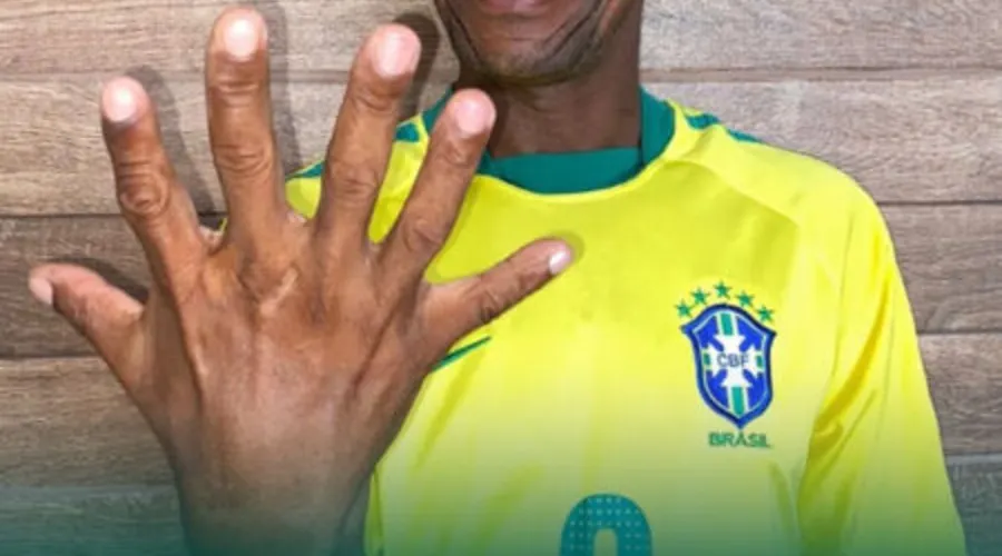 Imagem ilustrativa da imagem Baiano de seis dedos vira símbolo do hexa na Copa do Mundo