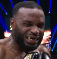Imagem ilustrativa da imagem Lutador de MMA perde os dentes após sequência de soco; veja vídeo