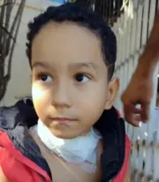 Imagem ilustrativa da imagem Menino de 5 anos tem pescoço cortado por linha chilena em Niterói