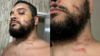 Imagem ilustrativa da imagem Estudante alega ter sido agredido por namorado do pai