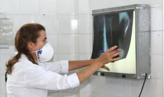 Imagem ilustrativa da imagem Tuberculose volta a assustar: Brasil registra 78 mil novos casos