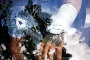 Imagem ilustrativa da imagem 'Nasci de novo', diz guarda ao ser atingido por estilhaços de bala
