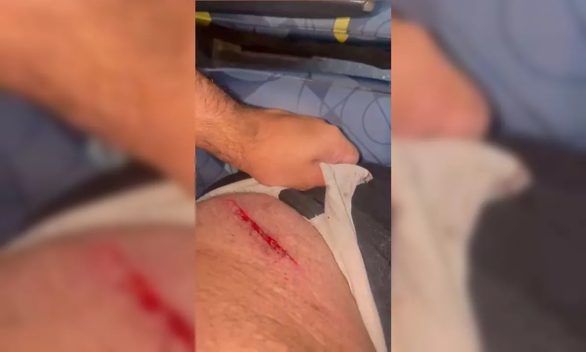 Banco de ônibus 'voa', rasga roupa e fere passageiro em SG; vídeo