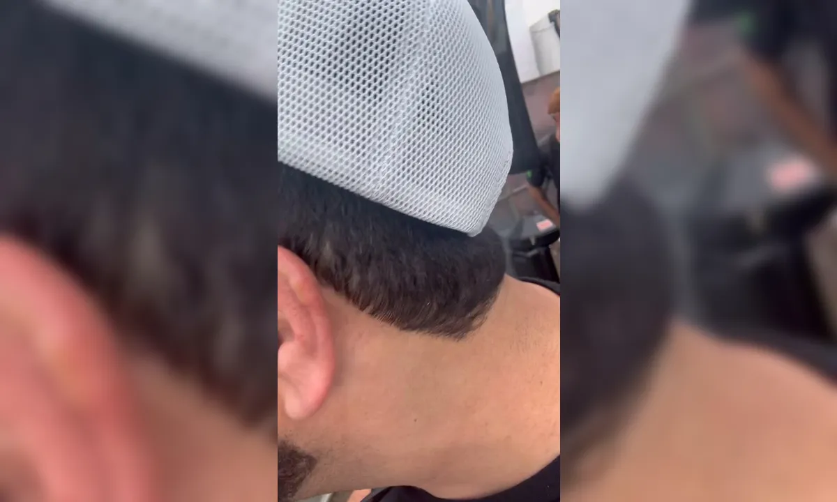 Cantor sertanejo sofre queimaduras no rosto durante show; vídeo