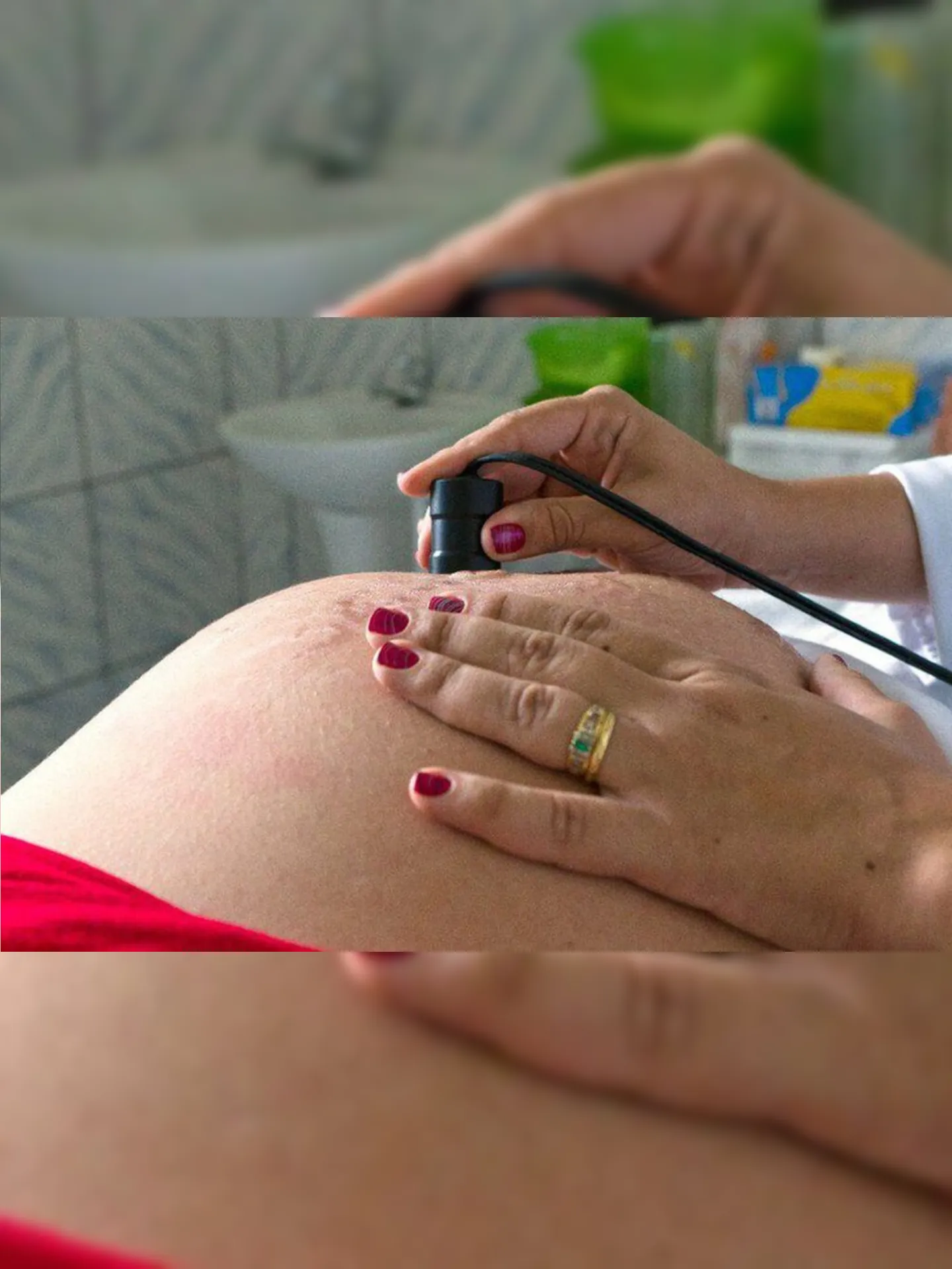 Imagem ilustrativa da imagem Registro de nascimento poderá ser feito em maternidades públicas de Niterói